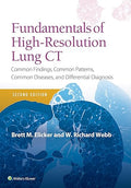 Fundamentals of High-Resolution Lung CT: Common Findings, Common Patterns, Common Diseases and Differential Diagnosis
