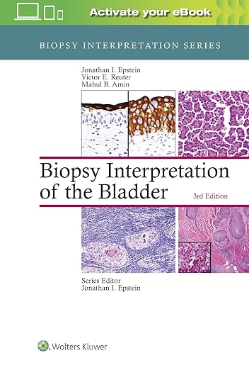 Biopsy Interpretation of the Bladder