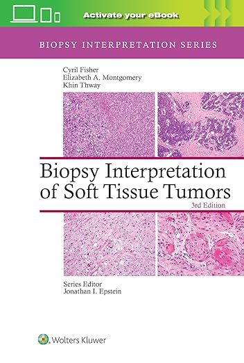 Biopsy Interpretation of Soft Tissue Tumors: Print + eBook with Multimedia (Biopsy Interpretation Series)