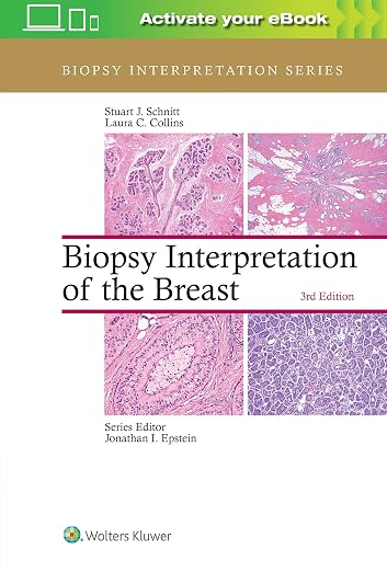 Biopsy Interpretation of the Breast
