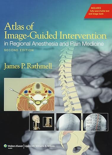 Atlas of Image-Guided Intervention in Regional Anesthesia and Pain Medicine